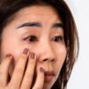 Alterações nos olhos podem ser sinal de deficiência nutricional