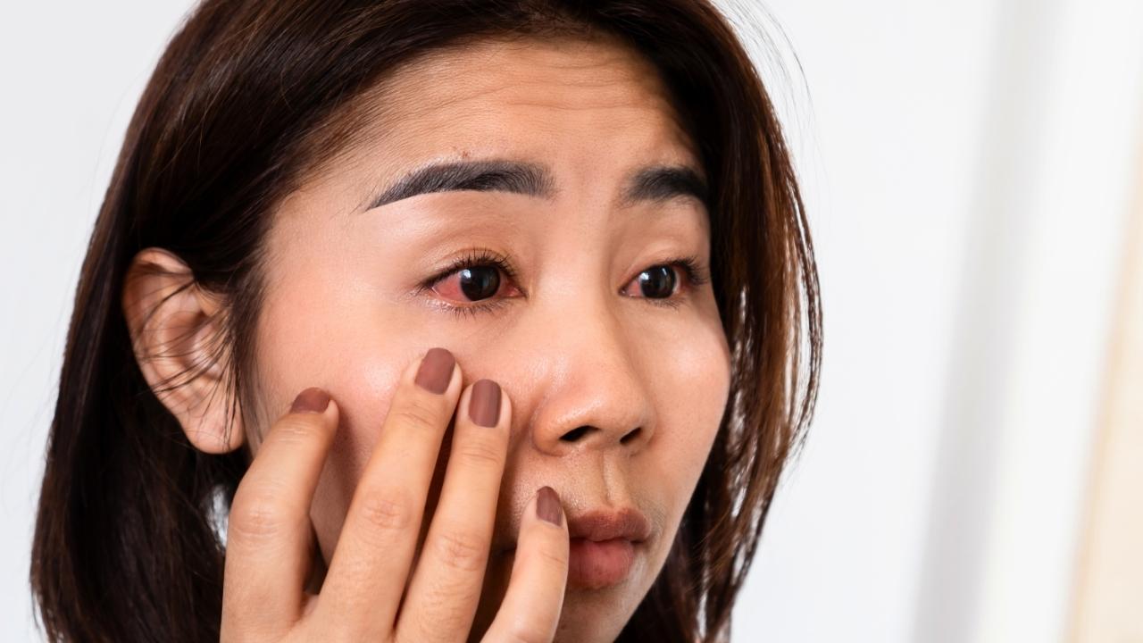 Alterações nos olhos podem ser sinal de deficiência nutricional