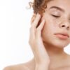 Mulher com melasma