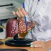 A esteatose hepática pode se desenvolver por anos sem causar sintomas, tornando a prevenção ainda mais importante