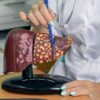 Imagem de uma médica apontando para uma peça de plástico de um fígado com gordura