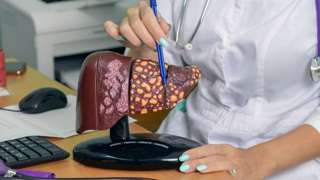 Imagem de uma médica apontando para uma peça de plástico de um fígado com gordura