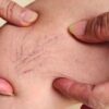 Saúde vascular após os 40: sinais, doenças e como proteger suas pernas