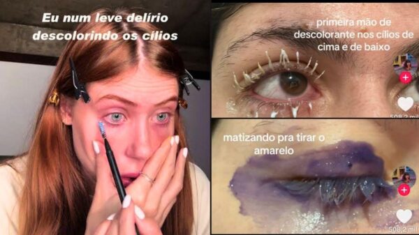Trend de cílios descoloridos no TikTok preocupa oftalmologistas