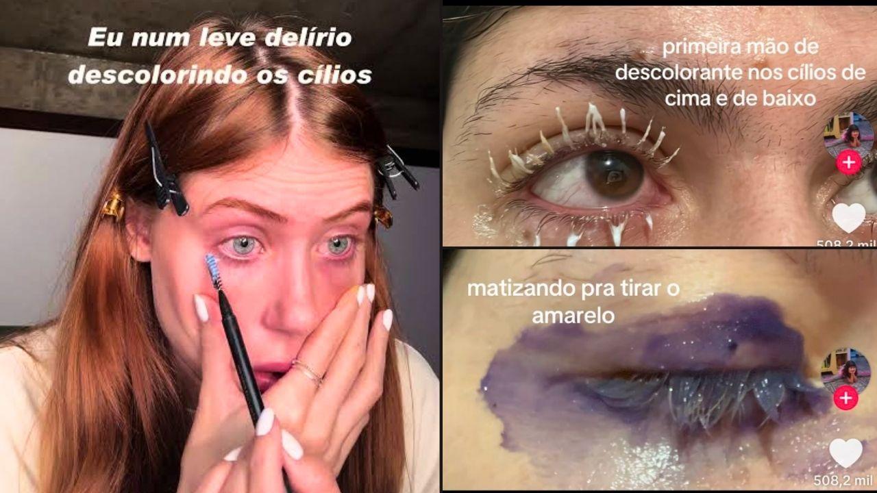 Trend de cílios descoloridos no TikTok preocupa oftalmologistas
