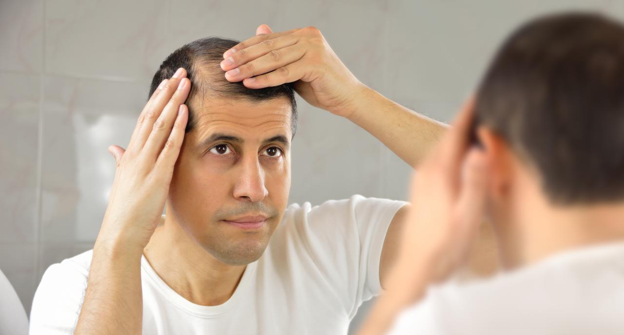 Homem se olhando no espelho vendo que está ficando calvo.