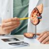 Foto representativa de um rim pela metade para mostrar a anatomia na mão de um médico.
