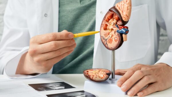 Foto representativa de um rim pela metade para mostrar a anatomia na mão de um médico.