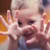 Doença mão-pé-boca volta a preocupar famílias com o retorno às aulas