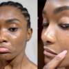 Erika Januza revelou nas redes sociais que teve uma reação alérgica após comer peixe frito na gordura de camarão