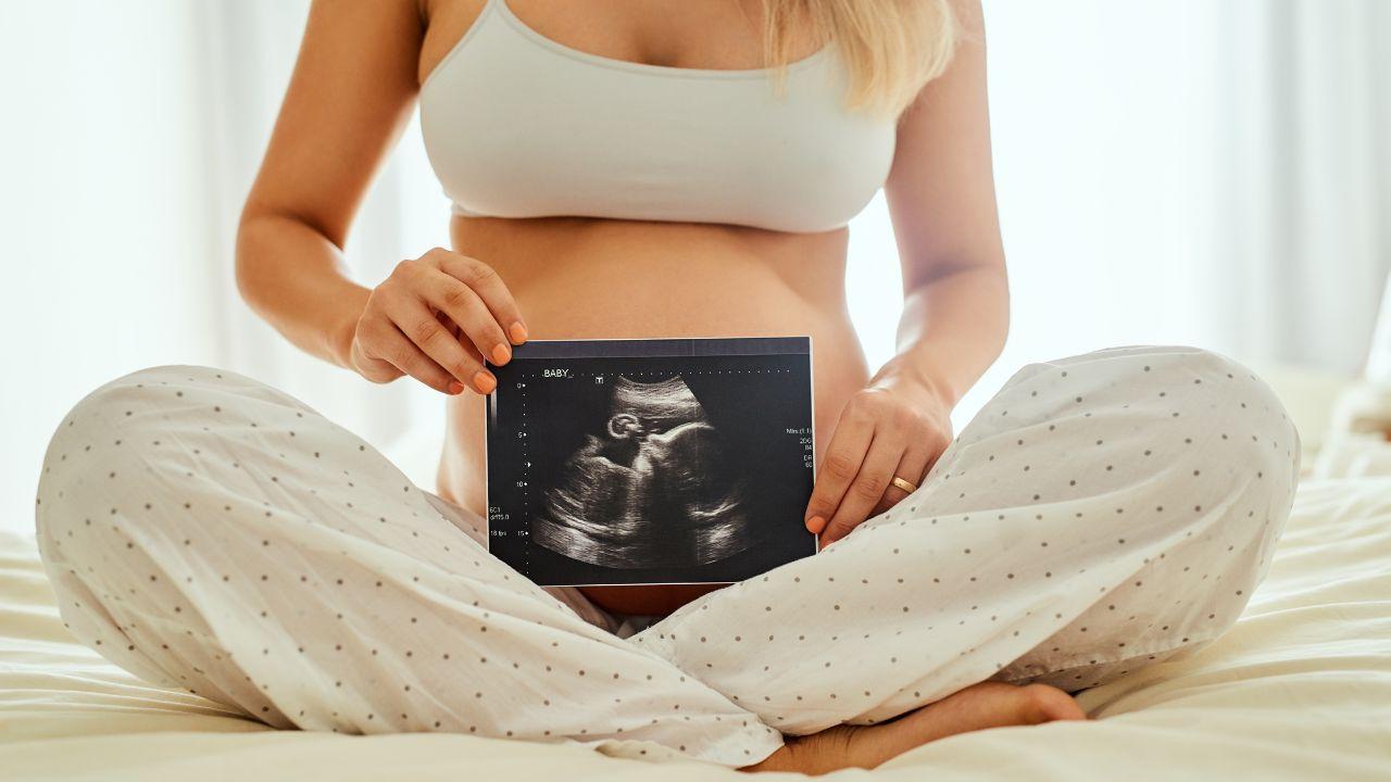 Imagem de uma mulher grávida segurando um ultrassom com imagem na frente da barriga