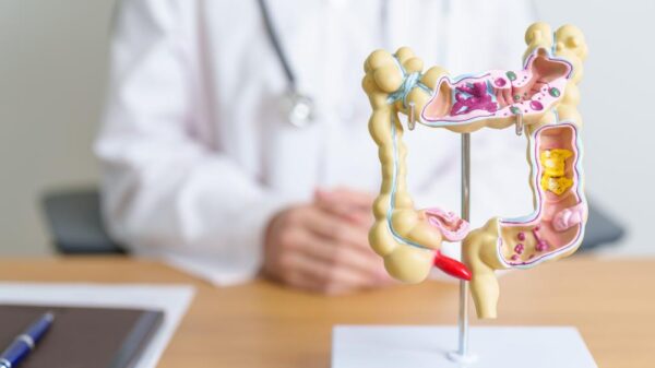 Foto mostra um médico no fundo desfocado com uma representação do sistema digestivo.