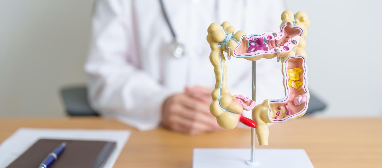 Foto mostra um médico no fundo desfocado com uma representação do sistema digestivo.