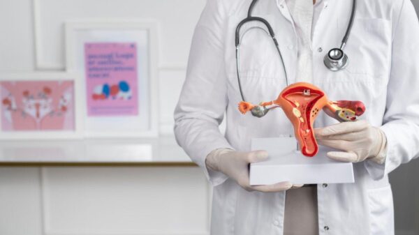 Imagem de um médico segurando uma peça de plástico de um útero