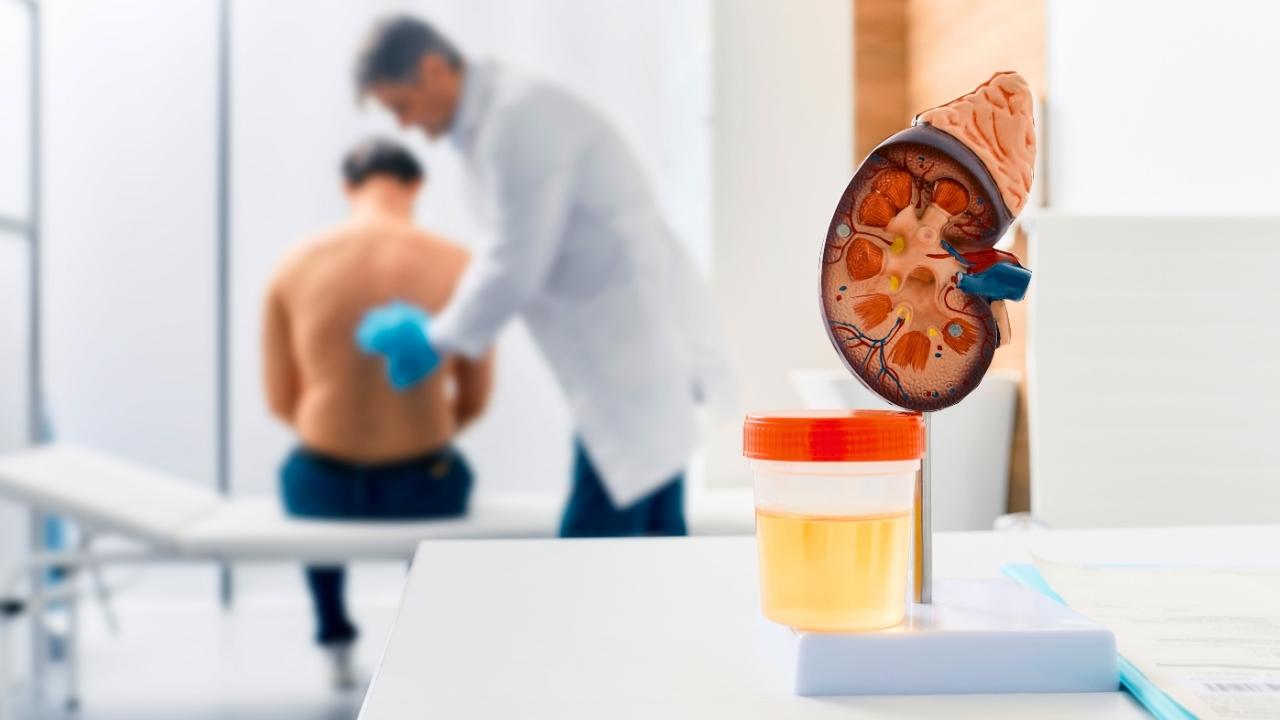 Doença renal policística: cistos podem exigir hemodiálise?