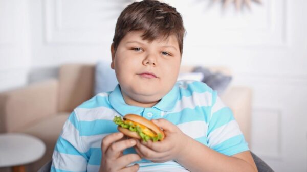Obesidade infantil: 5 cuidados que ajudam a mudar os hábitos das crianças
