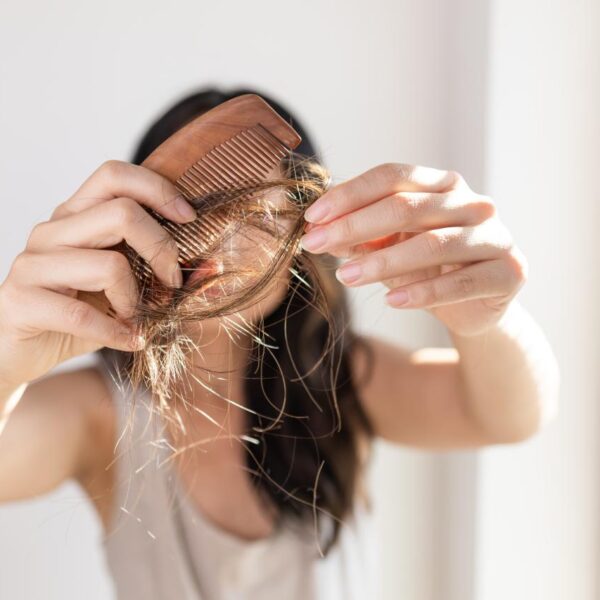 queda de cabelo