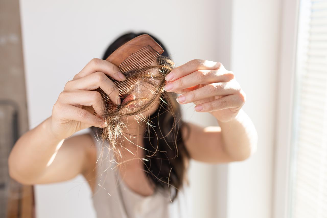 queda de cabelo