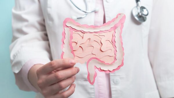 representação de um intestino