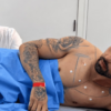 : Rico Melquiades durante procedimento realizado pelo médico Chris Lima