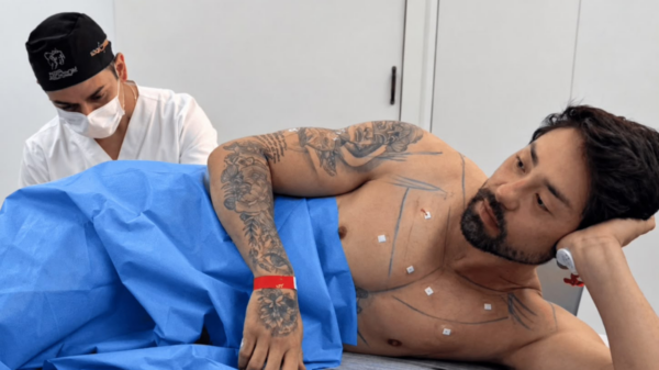 : Rico Melquiades durante procedimento realizado pelo médico Chris Lima