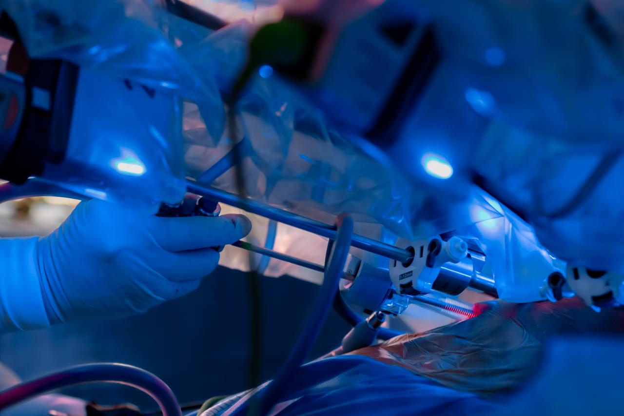 Foto mostra uma cirurgia robótica sendo feita.